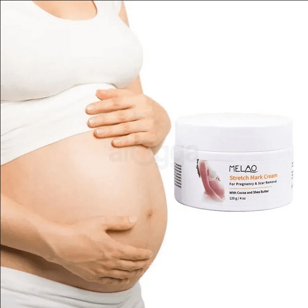 Melao Stretch Mark Cream for Pregnancy & Scar Removal with Cocoa & Shea Butter-120g
